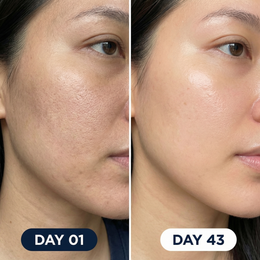 Dry skin