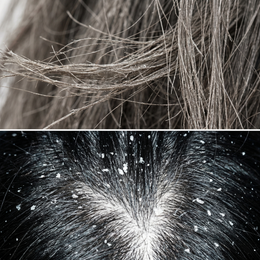 Flaky scalp